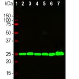 Western Blot - Anti-UCH-L1 Antibody [BH7] (A85351) - Antibodies.com