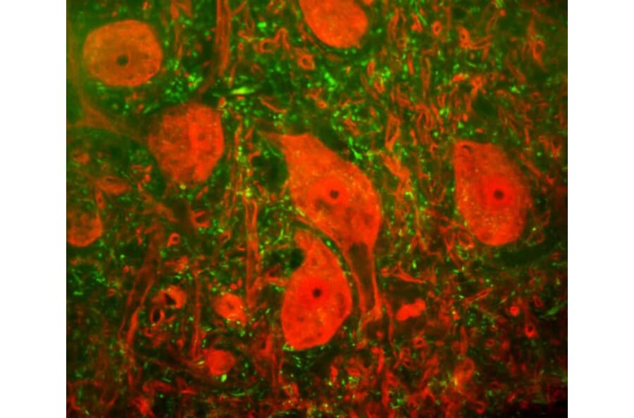 Immunofluorescence - Anti-UCHL1 Antibody [BH7] (A85351) - Antibodies.com