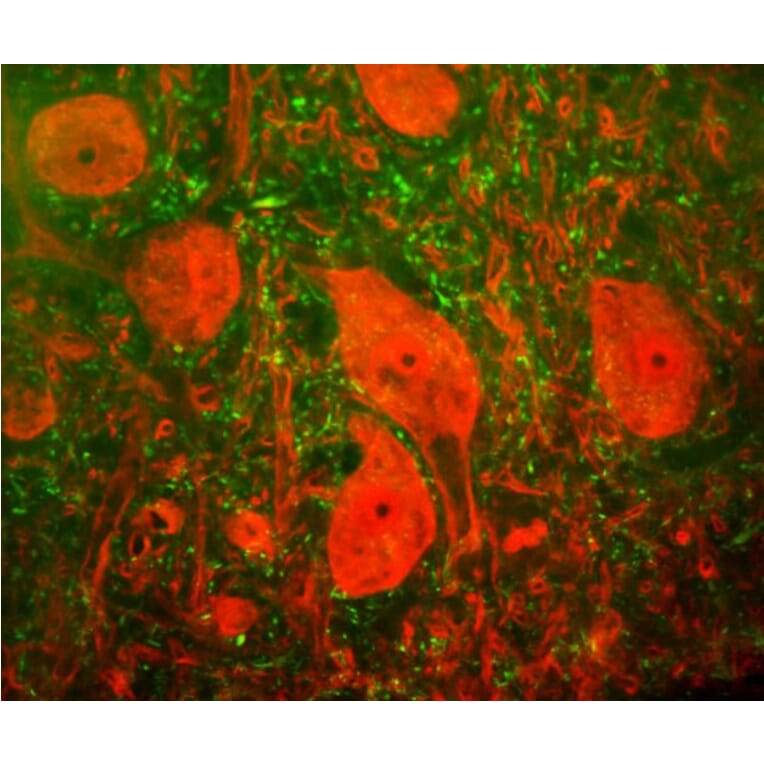 Immunofluorescence - Anti-UCHL1 Antibody [BH7] (A85351) - Antibodies.com