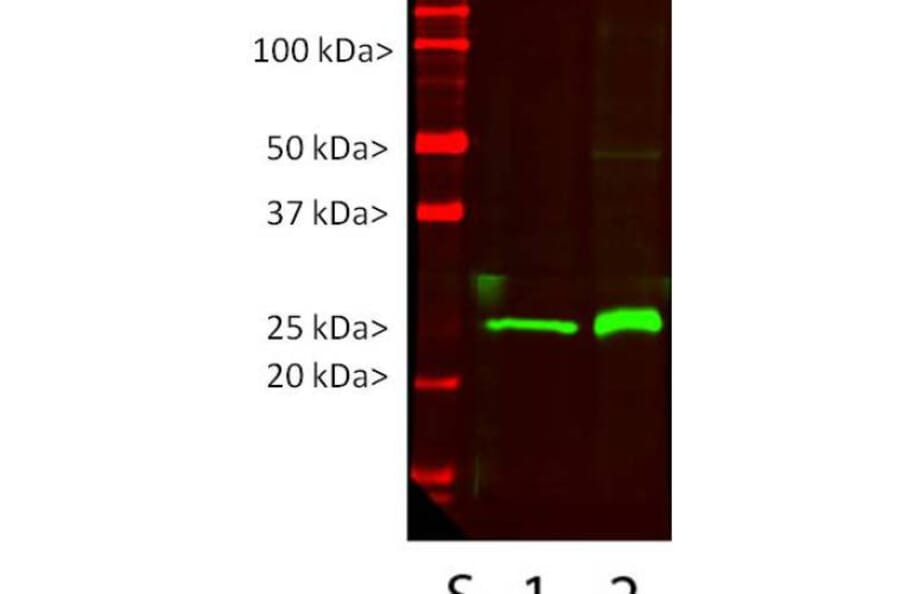 Western Blot - Anti-UCHL1 Antibody [BH7] (A85351) - Antibodies.com