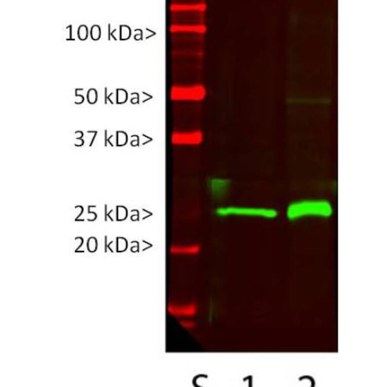 Western Blot - Anti-UCHL1 Antibody [BH7] (A85351) - Antibodies.com