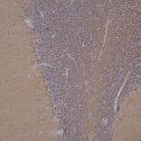 Immunohistochemistry - Anti-UCHL1 Antibody [BH7] (A85351) - Antibodies.com