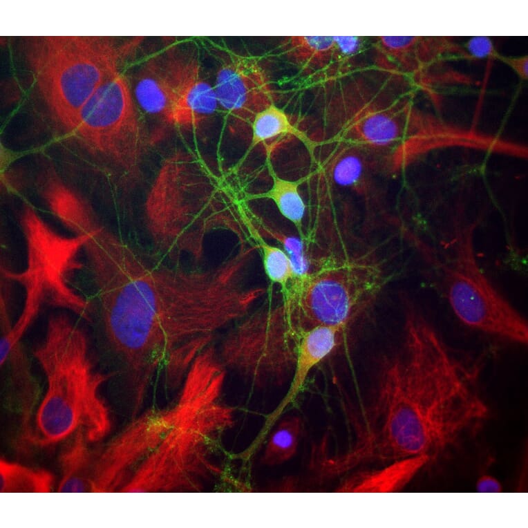 Immunofluorescence - Anti-alpha II Spectrin Antibody (A85352) - Antibodies.com