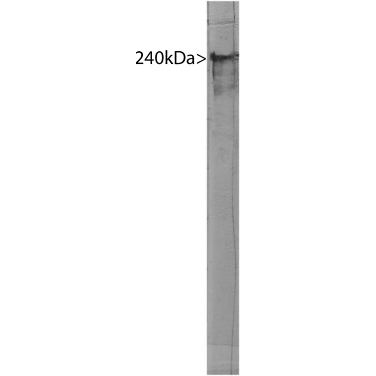 Western Blot - Anti-alpha II Spectrin Antibody [3D7] (A85353) - Antibodies.com