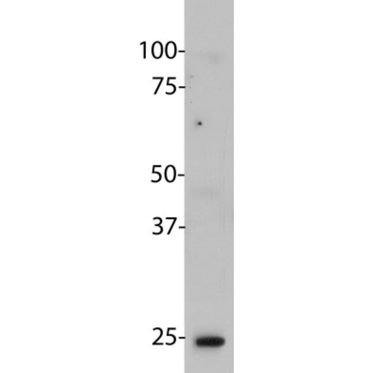 Western Blot - Anti-HMGB1 Antibody [1F3] (A85355) - Antibodies.com