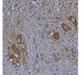 Immunohistochemistry - Anti-HSP27 Antibody (A85356) - Antibodies.com