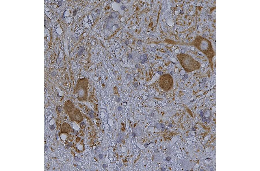 Immunohistochemistry - Anti-HSP27 Antibody (A85356) - Antibodies.com