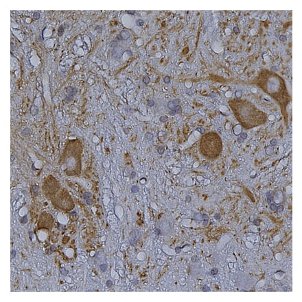Immunohistochemistry - Anti-HSP27 Antibody (A85356) - Antibodies.com