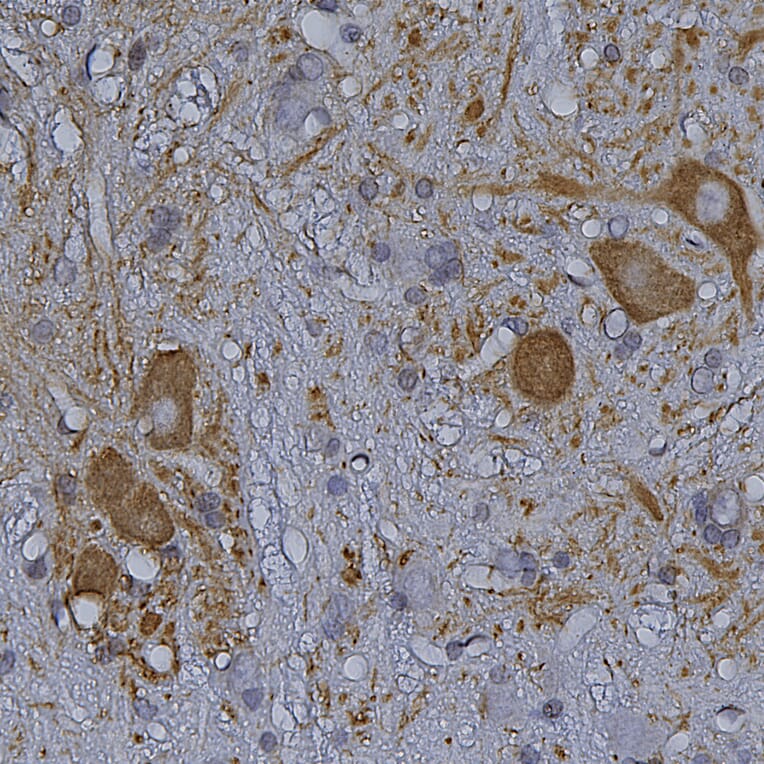 Immunohistochemistry - Anti-HSP27 Antibody (A85356) - Antibodies.com