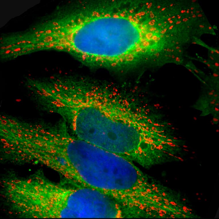 Immunofluorescence - Anti-Heat Shock Protein 27 Antibody (A85356) - Antibodies.com