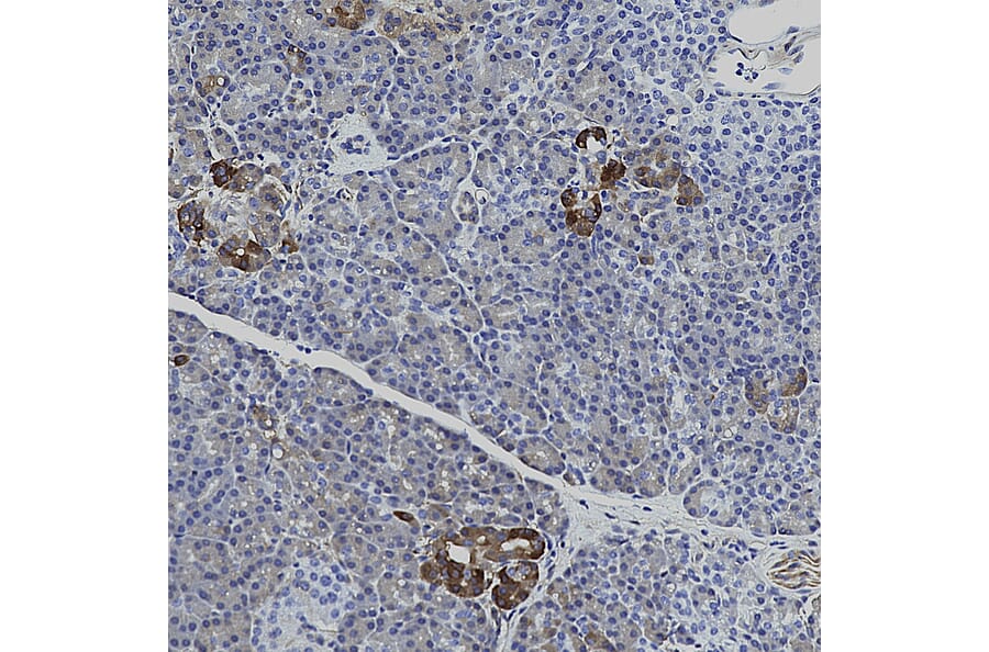 Immunohistochemistry - Anti-HSP27 Antibody [6H11] (A85358) - Antibodies.com