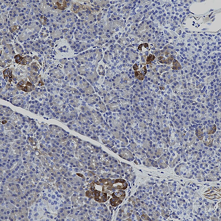Immunohistochemistry - Anti-HSP27 Antibody [6H11] (A85358) - Antibodies.com