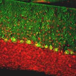 Immunofluorescence - Anti-Calbindin Antibody (A85359) - Antibodies.com