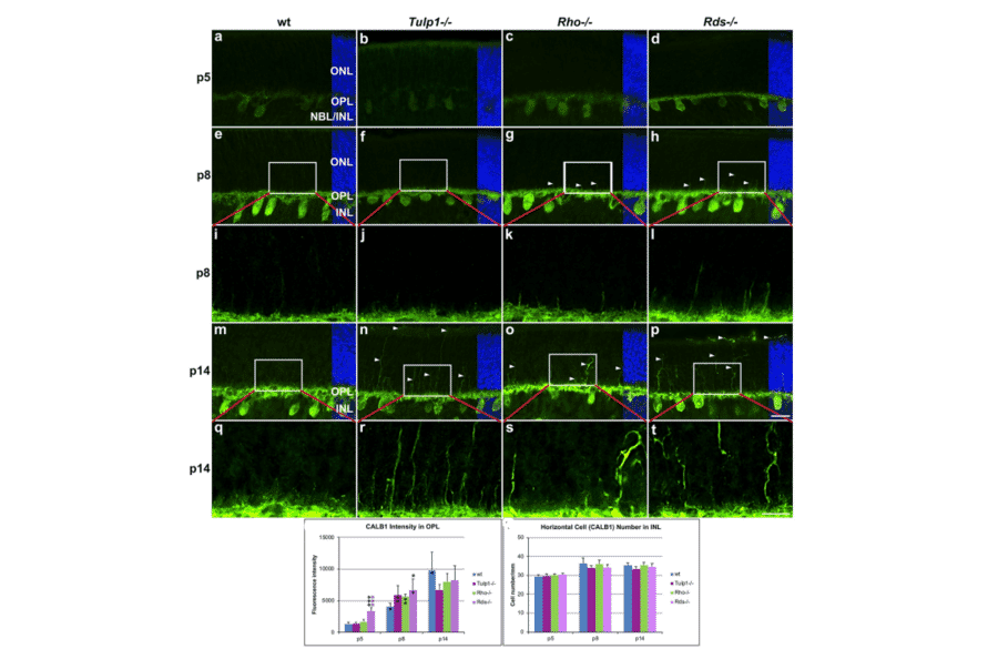 Immunocytochemistry - Anti-Calbindin Antibody - Antibodies.com