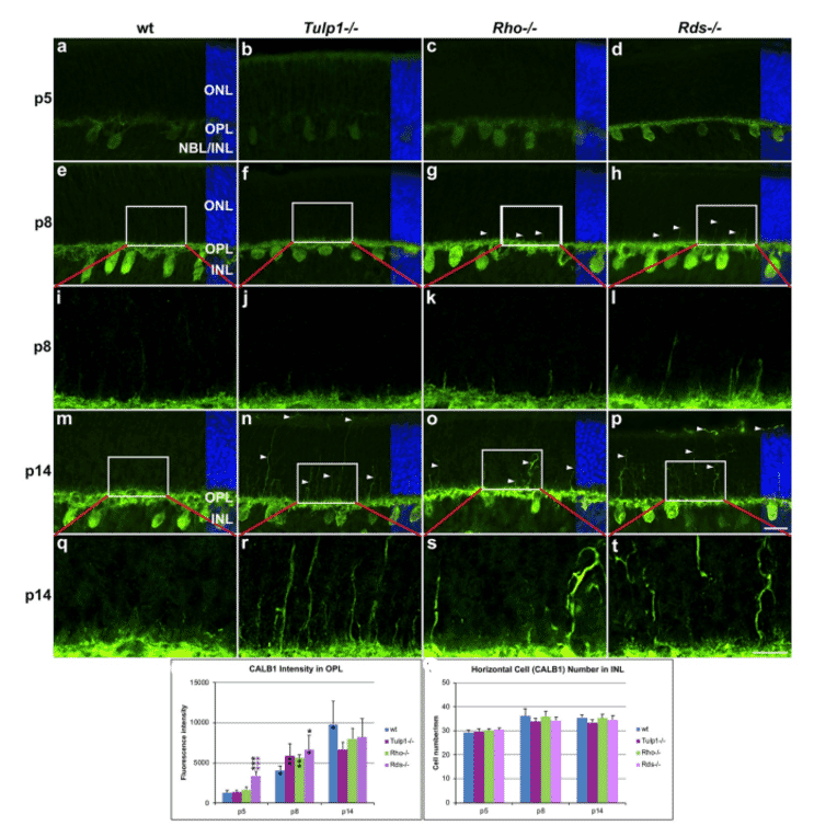 Immunocytochemistry - Anti-Calbindin Antibody - Antibodies.com