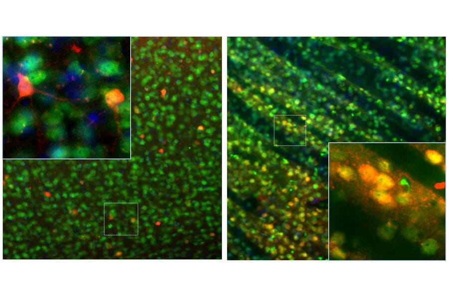 Immunofluorescence - Anti-Calbindin Antibody (A85359) - Antibodies.com