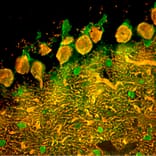 Immunofluorescence - Anti-Calbindin Antibody (A85359) - Antibodies.com