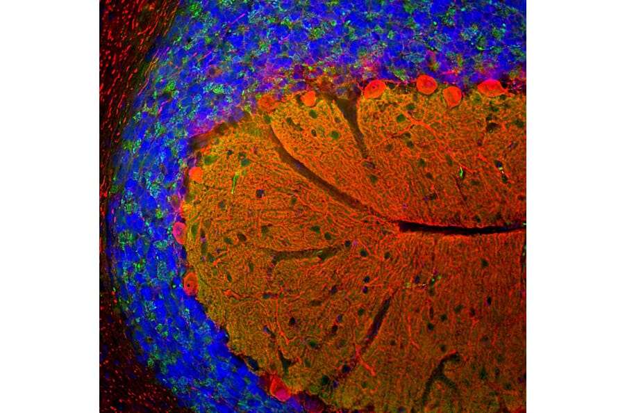 Immunofluorescence - Anti-Calbindin Antibody (A85359) - Antibodies.com