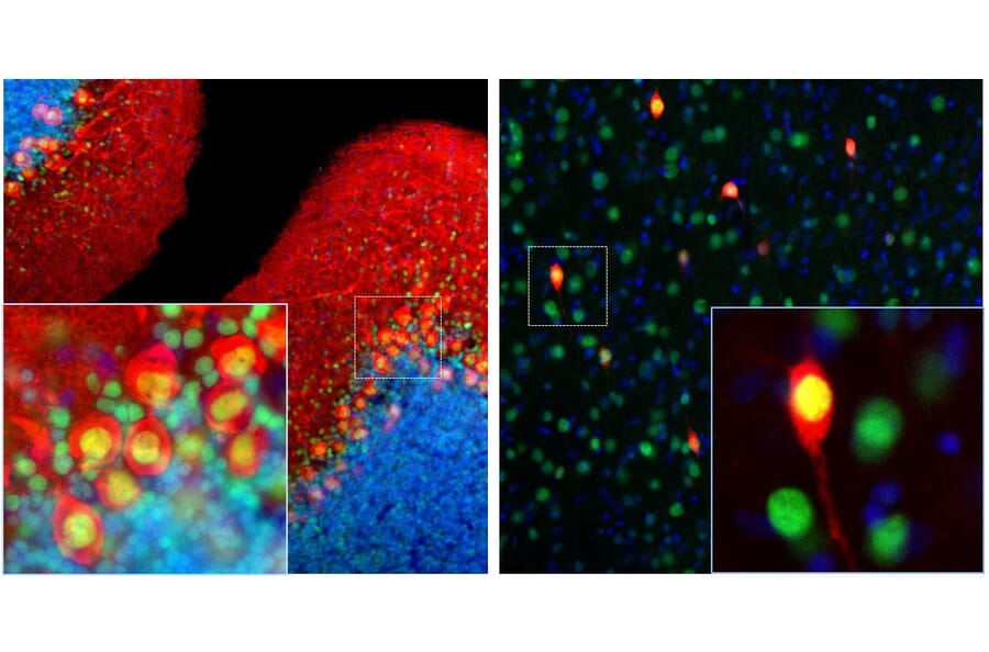 Immunofluorescence - Anti-Calbindin Antibody [4H7] (A85360) - Antibodies.com
