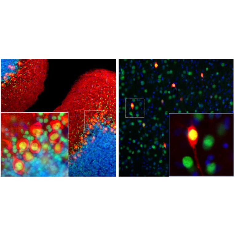 Immunofluorescence - Anti-Calbindin Antibody [4H7] (A85360) - Antibodies.com