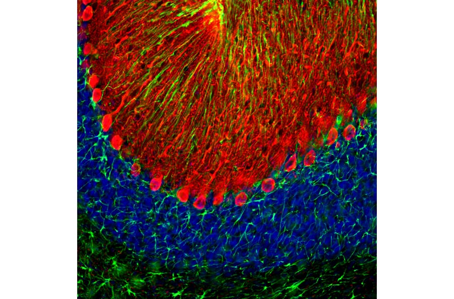 IHC - Anti-Calbindin Antibody [5A9] (A85362)