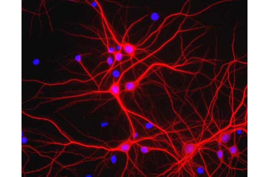 Immunofluorescence - Anti-MAP2 Antibody (A85363) - Antibodies.com