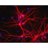 Immunofluorescence - Anti-MAP2 Antibody (A85363) - Antibodies.com