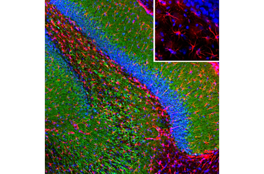 Immunofluorescence - Anti-MAP2 Antibody (A85363) - Antibodies.com