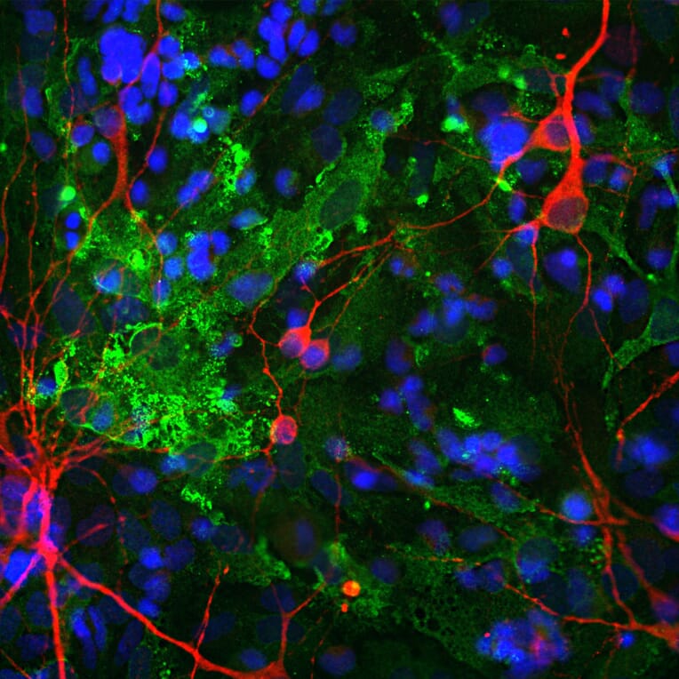 Immunofluorescence - Anti-MAP2 Antibody (A85363) - Antibodies.com