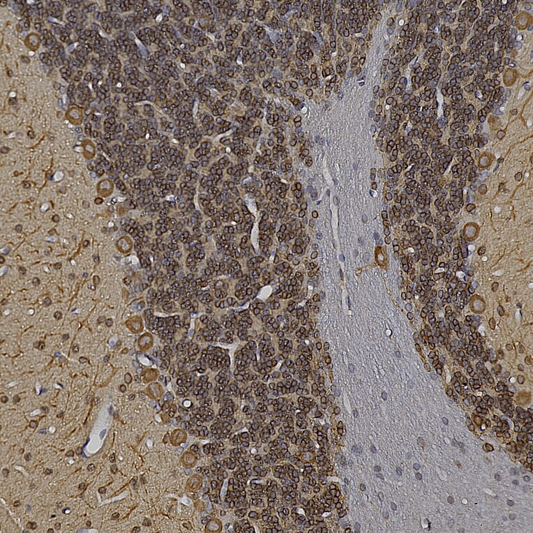 Immunohistochemistry - Anti-MAP2 Antibody (A85363) - Antibodies.com