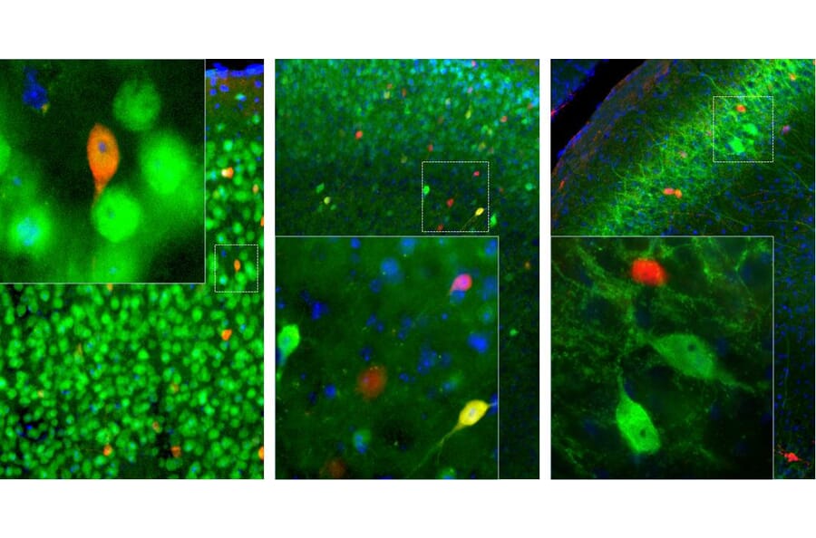 Immunofluorescence - Anti-Calretinin Antibody (A85364) - Antibodies.com
