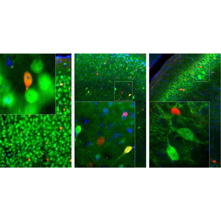 Immunofluorescence - Anti-Calretinin Antibody (A85364) - Antibodies.com