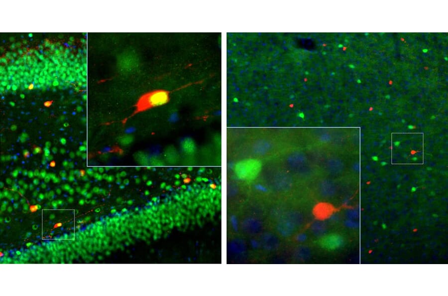 Immunofluorescence - Anti-Calretinin Antibody (A85365) - Antibodies.com
