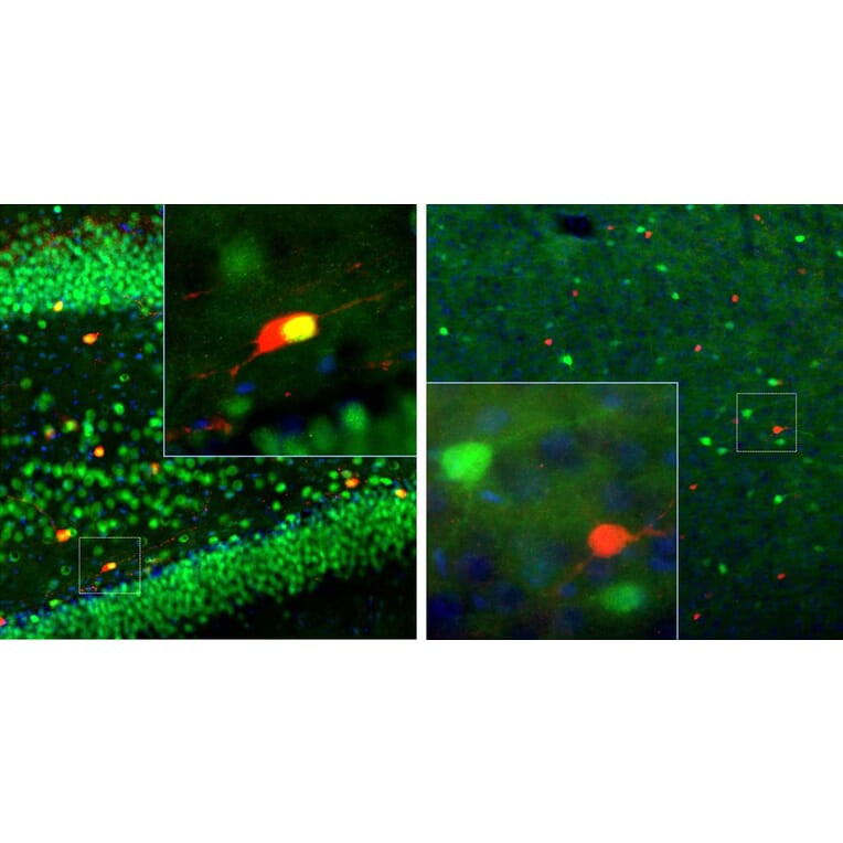 Immunofluorescence - Anti-Calretinin Antibody (A85365) - Antibodies.com