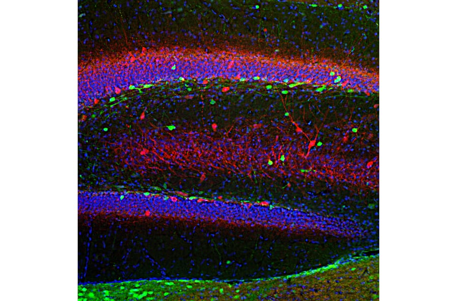 Immunohistochemical staining of a brain hippocampus section for calretinin and parvalbumin
