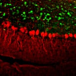 Immunofluorescence - Anti-Calretinin Antibody (A85367) - Antibodies.com