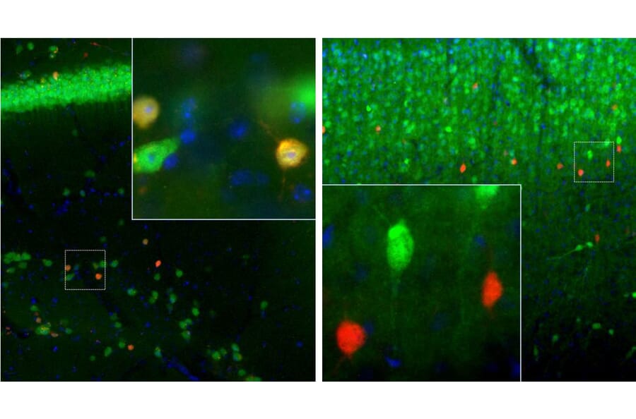 Immunofluorescence - Anti-Calretinin Antibody [3G9] (A85367) - Antibodies.com