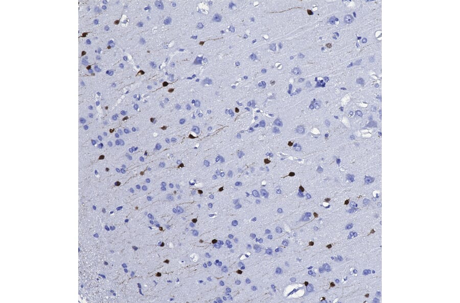 Immunohistochemistry - Anti-Calretinin Antibody [3G9] (A85367) - Antibodies.com
