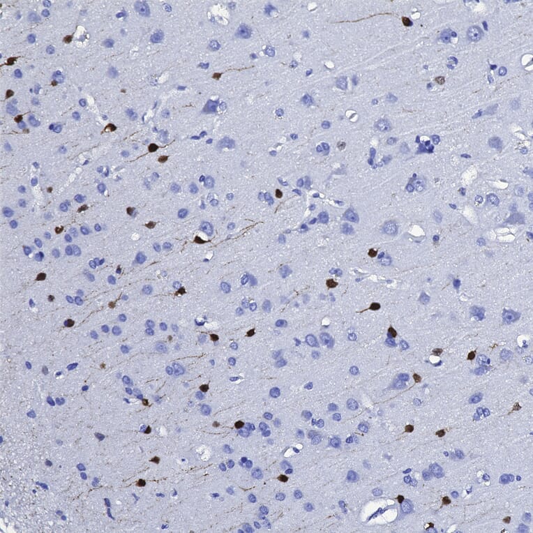 Immunohistochemistry - Anti-Calretinin Antibody [3G9] (A85367) - Antibodies.com