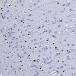Immunohistochemistry - Anti-Calretinin Antibody [3G9] (A85367) - Antibodies.com