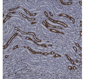 Immunohistochemistry - Anti-Galectin 3 Antibody [5C21] (A85368) - Antibodies.com