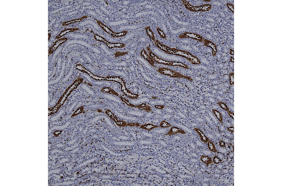 Immunohistochemistry - Anti-Galectin 3 Antibody [5C21] (A85368) - Antibodies.com