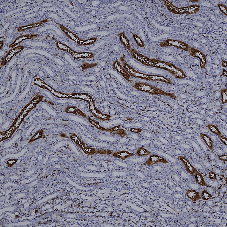 Immunohistochemistry - Anti-Galectin 3 Antibody [5C21] (A85368) - Antibodies.com