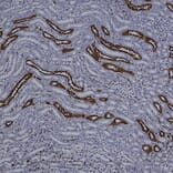 Immunohistochemistry - Anti-Galectin 3 Antibody [5C21] (A85368) - Antibodies.com