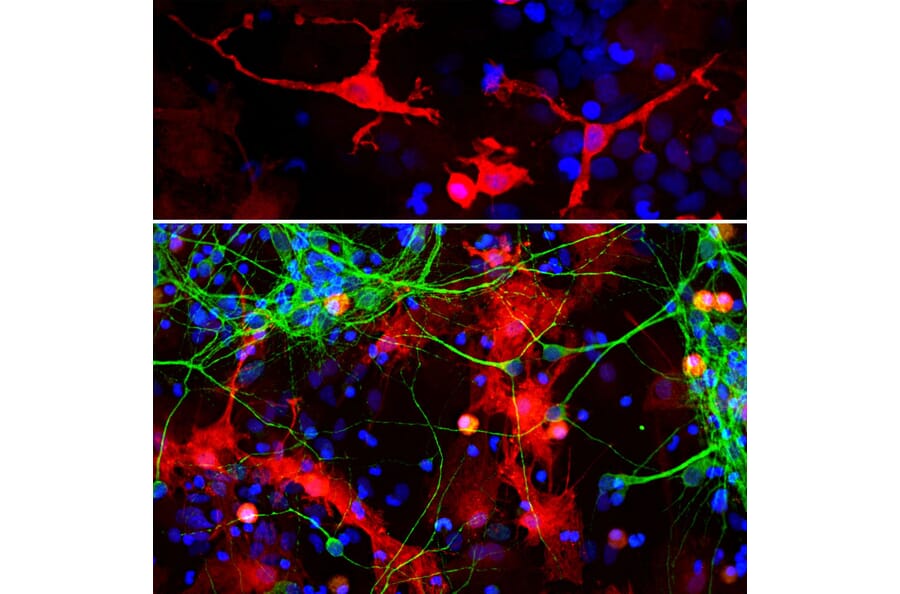 Immunofluorescence - Anti-Galectin 3 Antibody [5C21] (A85368) - Antibodies.com