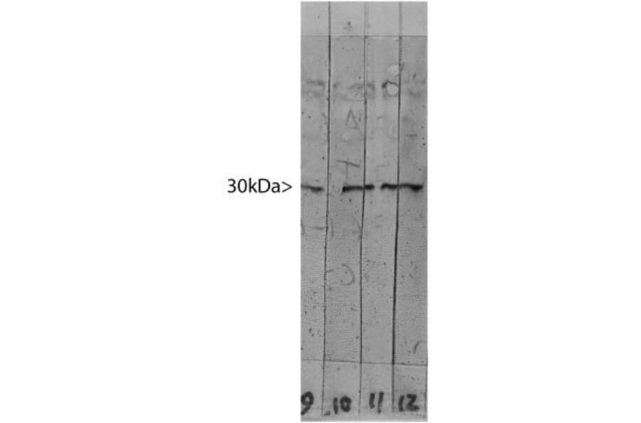 Western Blot - Anti-Galectin 3 Antibody [5C21] (A85368) - Antibodies.com