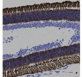 Immunohistochemistry - Anti-Rhodopsin Antibody [B630] (A85373) - Antibodies.com