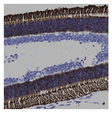 Immunohistochemistry - Anti-Rhodopsin Antibody [B630] (A85373) - Antibodies.com