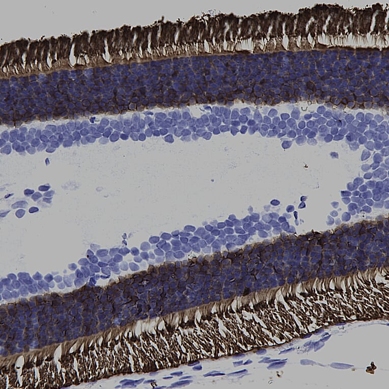 Immunohistochemistry - Anti-Rhodopsin Antibody [B630] (A85373) - Antibodies.com