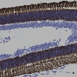 Immunohistochemistry - Anti-Rhodopsin Antibody [B630] (A85373) - Antibodies.com